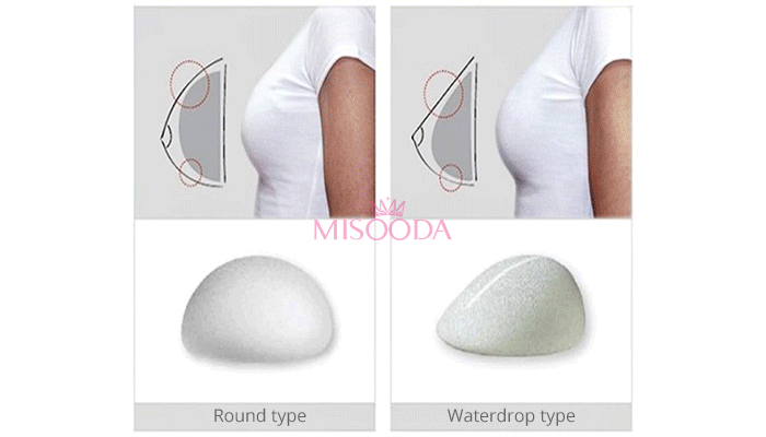 Why Korean Breast Augmentation Guide Reviews Promotions Misooda