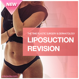 Liposuction Revision