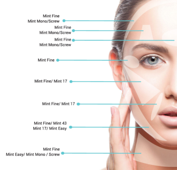 MIcro Lift Threads : Latest Revelation in Face and Body Lift