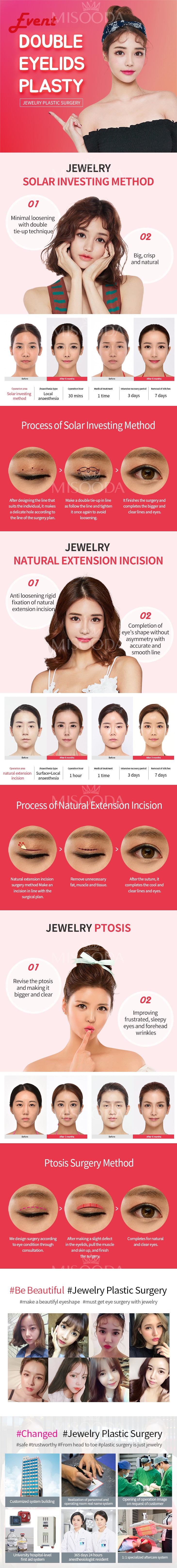 Double Eyelid Surgery (Contact MISOODA for price)