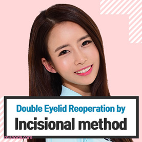 Double Eyelid Reopreation by incisional method (Contact MISOODA for price)