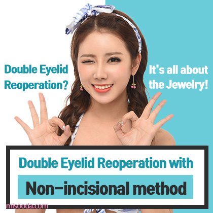 Double eyelid reoperation with Non-incisional method (Contact MISOODA for price)