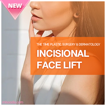 Incisional Face Lift