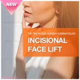 Incisional Face Lift