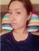 I still have some minor swellings, right?
I took a selfie yesterday, and I looked so good! 
But not today I guess… T.T

I practice mouth opening everyday~ 
It is summer, and it’s very hot to do warm towel massage, 
but I have fan that can cool me, so no worries~