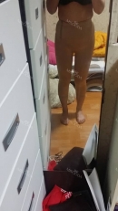 　一週間前に脂肪吸引術を行いました。 脂肪吸引後1ヶ月までは圧迫服を着用しなければなりませんでした。 ご覧のように切開部位から少し液体が出ています。これは特に心配する必要なく、正常な症状ということで、手術後1週間または2週間後に止まるということです。