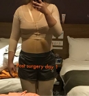 For second day surgery, I had about 3400cc removed frm my upper body.
Despite doing full body liposuction, I was still in good energy and was instructed to go back soon after two days for wounds cleaning! 
Their compression garment is functional and super toilet friendly! It's been a little sore kinda ache so far but it is within expectations! Kinda looking forward to my slimming journey.