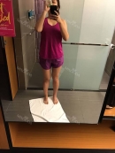 One month post review- Have been wearing the compression garments but limbs and all are still puffy. Weekly exercising help. The appetite restriction pills provided by 365MC help and people are starting to comment that I've lost weight.