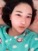 术后3周