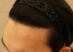 hairline