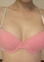 Breast surgery for confidence