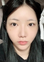 Facial Contour, Double Eyelid Surgery in TS PS!!