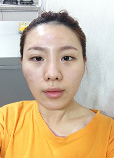 Reborn as a beauty with smooth oval face