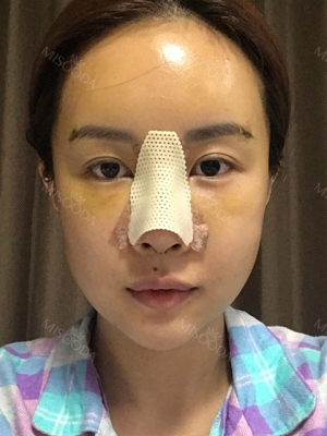 Operation: Nose