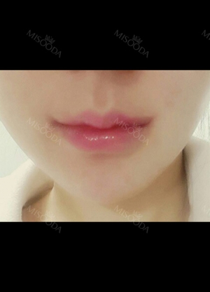 I absolutely love my lips!!!