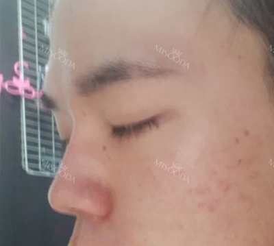 Wannabe Plastic Surgery, Reviews,Images, Promotions — Korea cost, reviews & before-after | MISOODA