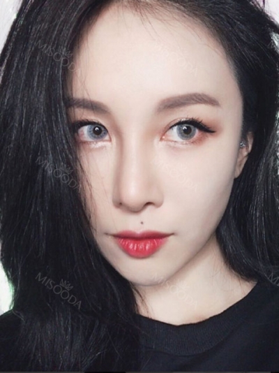 Cinderella Plastic Surgery,Reviews,Images,Promotions — Korea cost, reviews & before-after | MISOODA