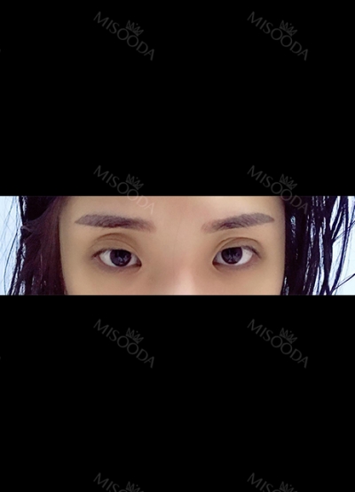 TOP FACE Plastic Surgery,Reviews,Images, Promotions — Korea cost, reviews & before-after | MISOODA
