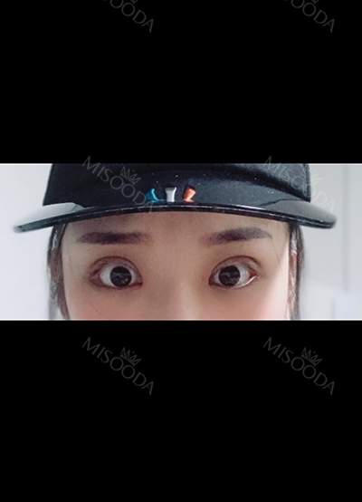 TOP FACE Plastic Surgery,Reviews,Images, Promotions — Korea cost, reviews & before-after | MISOODA